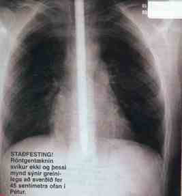 Petur Pokus X-ray
